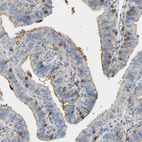 Anti-ANXA6 Antibody