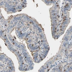 Immunohistochemical staining of human fallopian tube shows moderate cytoplasmic positivity in glandular cells.