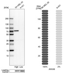 Western blot analysis in human cell lines SK-MEL-30 and A-431 using Anti-ANXA6 antibody. Corresponding ANXA6 RNA-seq data are presented for the same cell lines. Loading control: Anti-HSP90B1.