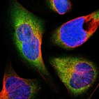 Immunofluorescent staining of human cell line U-2 OS shows localization to cytosol.