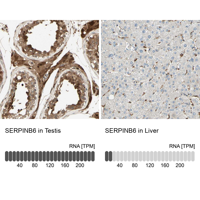 Anti-SERPINB6 Antibody