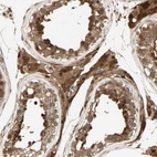 Immunohistochemical staining of human testis shows high expression.