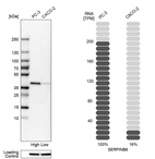 Western blot analysis in human cell lines PC-3 and Caco-2 using Anti-SERPINB6 antibody. Corresponding SERPINB6 RNA-seq data are presented for the same cell lines. Loading control: Anti-HSP90B1.