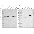 Western blot analysis using Anti-SERPINB6 antibody HPA009668 (A) shows similar pattern to independent antibody HPA012736 (B).