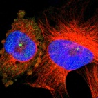 Immunofluorescent staining of human cell line U-251 MG shows localization to centrosome.