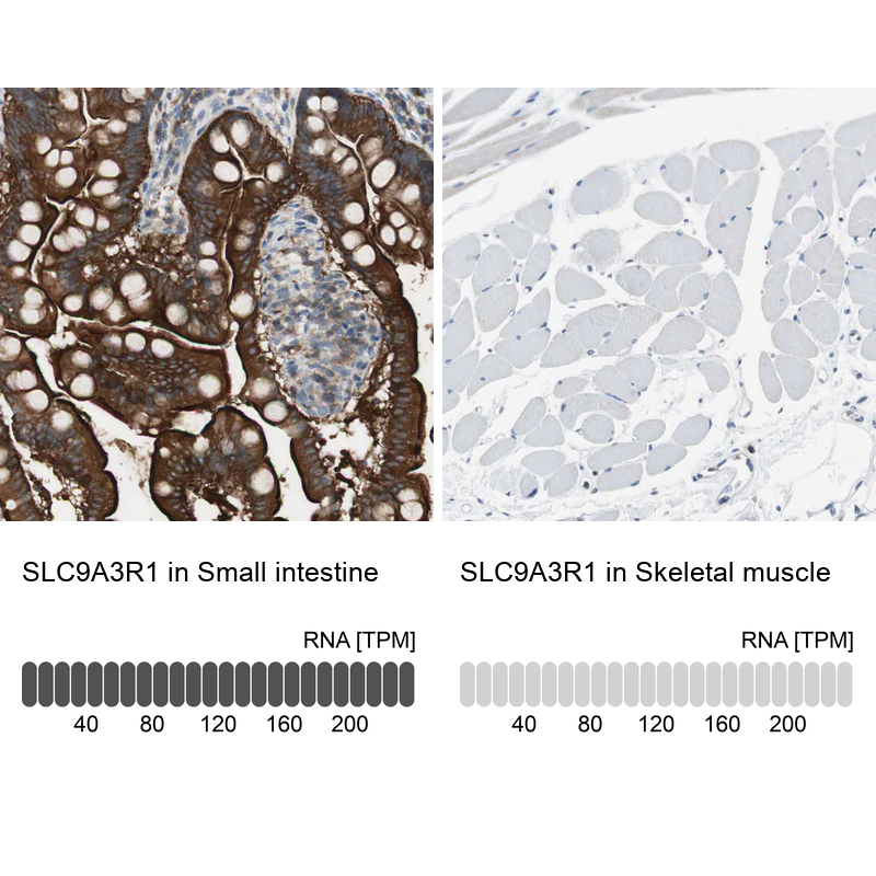 Anti-SLC9A3R1 Antibody