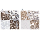 Immunohistochemical staining of human kidney, placenta, skeletal muscle and small intestine using Anti-SLC9A3R1 antibody HPA009672 (A) shows similar protein distribution across tissues to independent antibody HPA027247 (B).