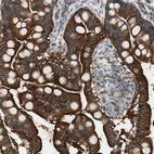 Immunohistochemical staining of human small intestine shows strong cytoplasmic and membranous positivity in glandular cells.