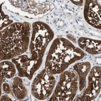 Immunohistochemical staining of human kidney shows strong cytoplasmic positivity in cells in tubules.