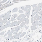 Immunohistochemical staining of human skeletal muscle shows no positivity in myocytes as expected.