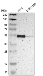 Western blot analysis in human cell line RT-4 and human cell line U-251 MG.