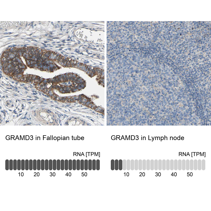 Anti-GRAMD3 Antibody