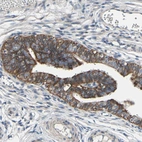 Immunohistochemical staining of human Fallopian tube shows strong cytoplasmic positivity in glandular cells.