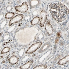Immunohistochemical staining of human kidney shows strong granular positivity in cytoplasm in cells in tubules.