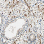 Anti-NDFIP1 Antibody