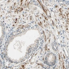 Immunohistochemical staining of human prostate shows moderate cytoplasmic positivity in smooth muscle cells.
