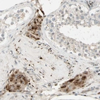 Immunohistochemical staining of human testis shows moderate granular cytoplasmic positivity in Leydig cells.