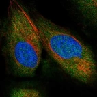 Immunofluorescent staining of human cell line U-2 OS shows localization to nucleoplasm & cytosol.