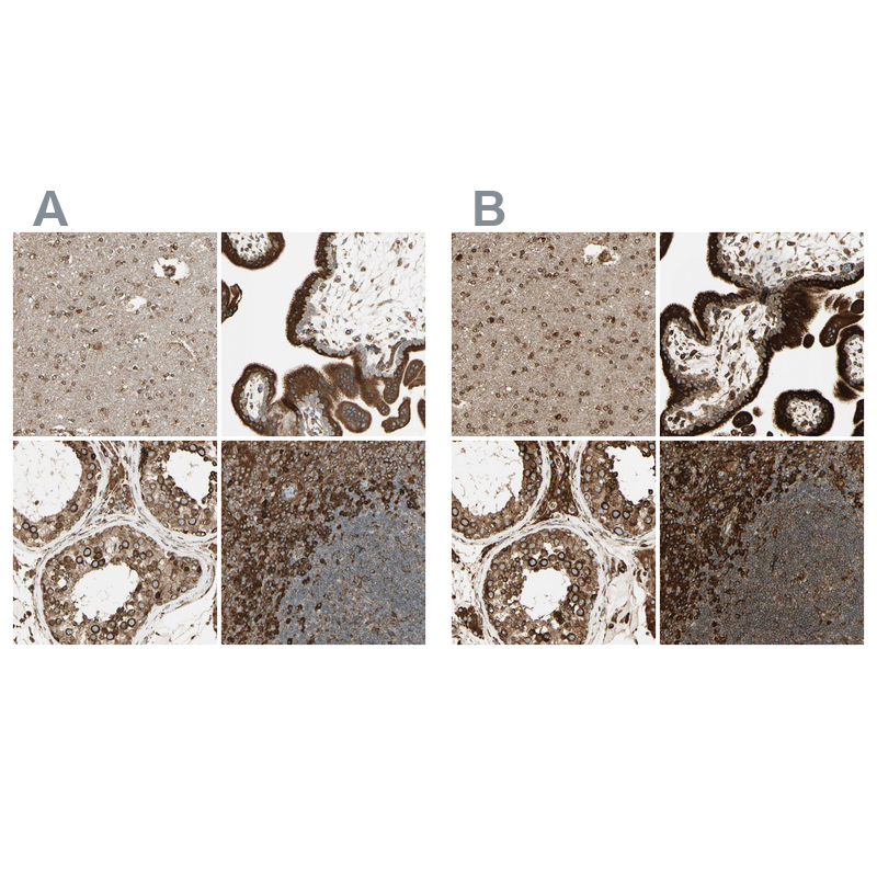 Anti-CANX Antibody