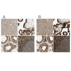 Anti-CANX Antibody
