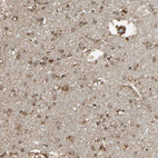 Immunohistochemical staining of human cerebral cortex shows strong cytoplasmic positivity in neurons.
