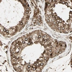 Immunohistochemical staining of human testis shows strong cytoplasmic positivity in cells in seminiferous ducts.