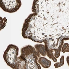 Immunohistochemical staining of human placenta shows strong cytoplasmic positivity in trophoblastic cells.