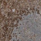 Immunohistochemical staining of human tonsil shows strong cytoplasmic positivity in non-germinal center cells.
