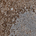 Immunohistochemical staining of human tonsil shows strong cytoplasmic positivity in non-germinal center cells.