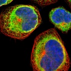 Immunofluorescent staining of human cell line A-431 shows localization to endoplasmic reticulum.