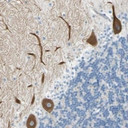 Anti-FRMD4B Antibody
