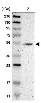 Lane 1: Marker [kDa] 230, 130, 95, 72, 56, 36, 28, 17, 11_br/_Lane 2: Human cell line RT-4