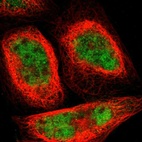 Immunofluorescent staining of human cell line A-431 shows localization to nucleoplasm & cytosol.