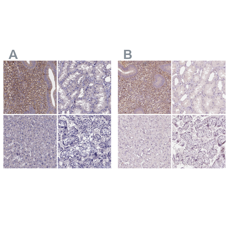 Anti-SFRP4 Antibody
