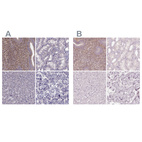 Anti-SFRP4 Antibody