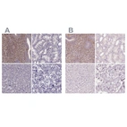 Anti-SFRP4 Antibody