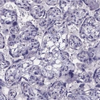 Immunohistochemical staining of human placenta shows no positivity in trophoblastic cells as expected.