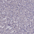 Immunohistochemical staining of human liver shows no positivity in hepatocytes as expected.