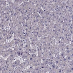 Immunohistochemical staining of human liver shows no positivity in hepatocytes as expected.