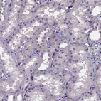 Immunohistochemical staining of human kidney shows no positivity in cells in tubules as expected.
