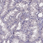 Immunohistochemical staining of human kidney shows no positivity in cells in tubules as expected.