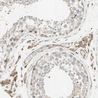 Anti-TRAF2 Antibody