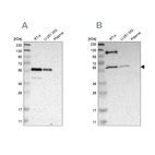 Western blot analysis using Anti-TRAF2 antibody HPA009972 (A) shows similar pattern to independent antibody HPA010634 (B).