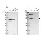 Western blot analysis using Anti-TRAF2 antibody HPA009972 (A) shows similar pattern to independent antibody HPA010634 (B).