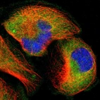 Immunofluorescent staining of human cell line U-251 MG shows localization to cytosol.