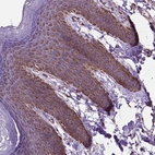 Immunohistochemical staining of human skin shows strong cytoplasmic granular positivity in squamous epithelial cells.