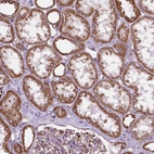Immunohistochemical staining of human kidney shows strong cytoplasmic granular positivity in cells in tubules.