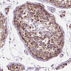 Immunohistochemical staining of human testis shows strong cytoplasmic granular positivity in cells in seminiferous ducts.
