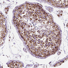 Anti-RMDN3 Antibody