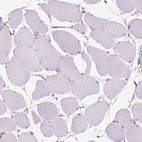 Anti-RMDN3 Antibody